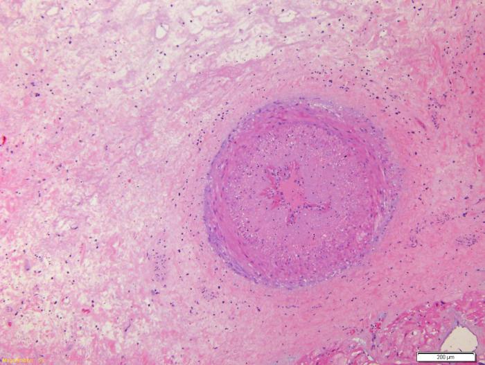https://cdn.ncbi.nlm.nih.gov/pmc/blobs/6605/10229782/e3288e56ce9d/fcvm-10-1123212-g005.jpg