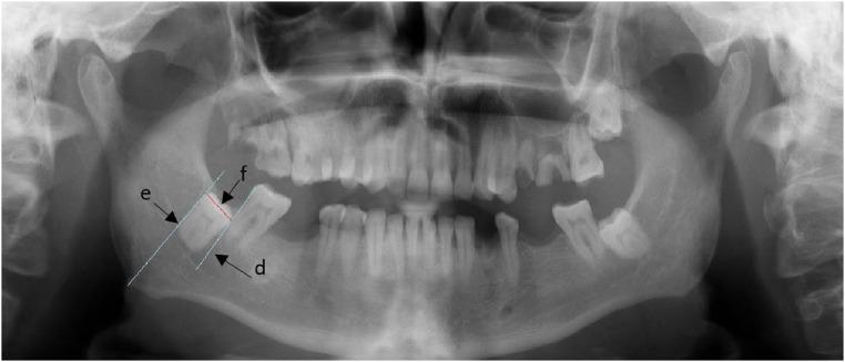 https://cdn.ncbi.nlm.nih.gov/pmc/blobs/6607/12066611/0e8eafdaebfe/froh-06-1524206-g002.jpg