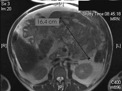 https://cdn.ncbi.nlm.nih.gov/pmc/blobs/6609/2918863/4684951528a9/cro0002-0144-f01.jpg