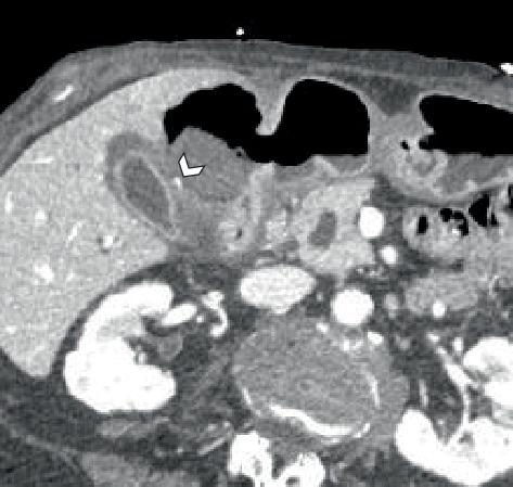https://cdn.ncbi.nlm.nih.gov/pmc/blobs/660b/12245491/38e361415cf7/CRIRA2025-2255883.003.jpg