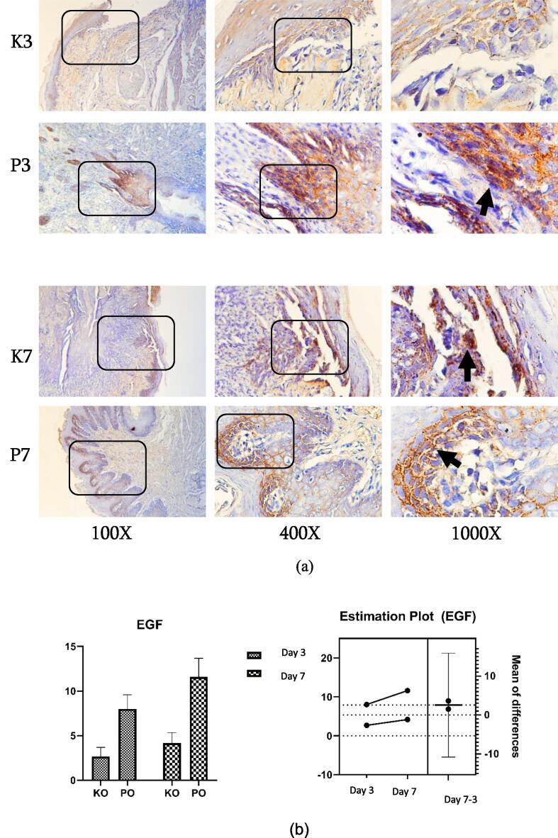 https://cdn.ncbi.nlm.nih.gov/pmc/blobs/660f/11178951/51d3ff64b2a8/gr3.jpg