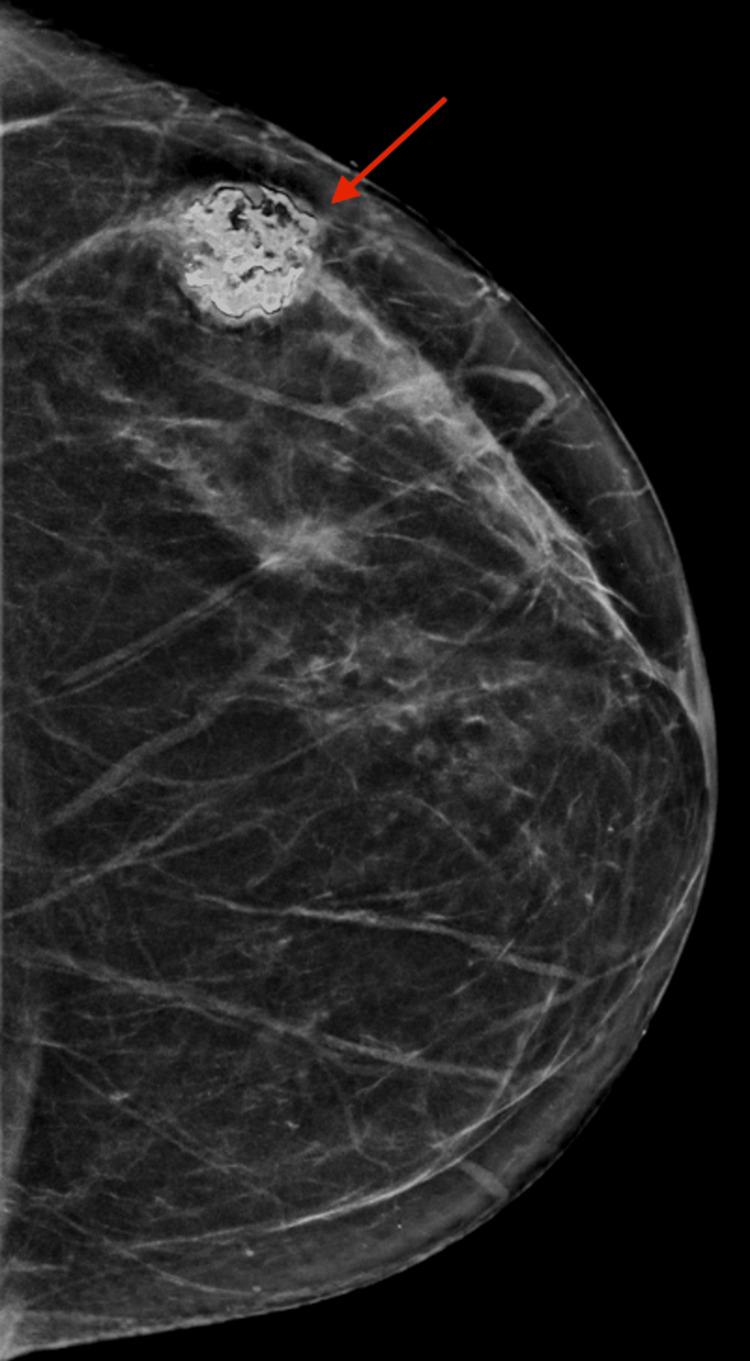 https://cdn.ncbi.nlm.nih.gov/pmc/blobs/6616/11298328/f9c293b86e75/cureus-0016-00000063915-i01.jpg