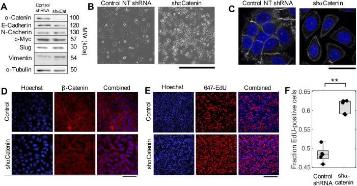 https://cdn.ncbi.nlm.nih.gov/pmc/blobs/6618/8098817/e9def5b4b66b/mbc-32-348-g004.jpg