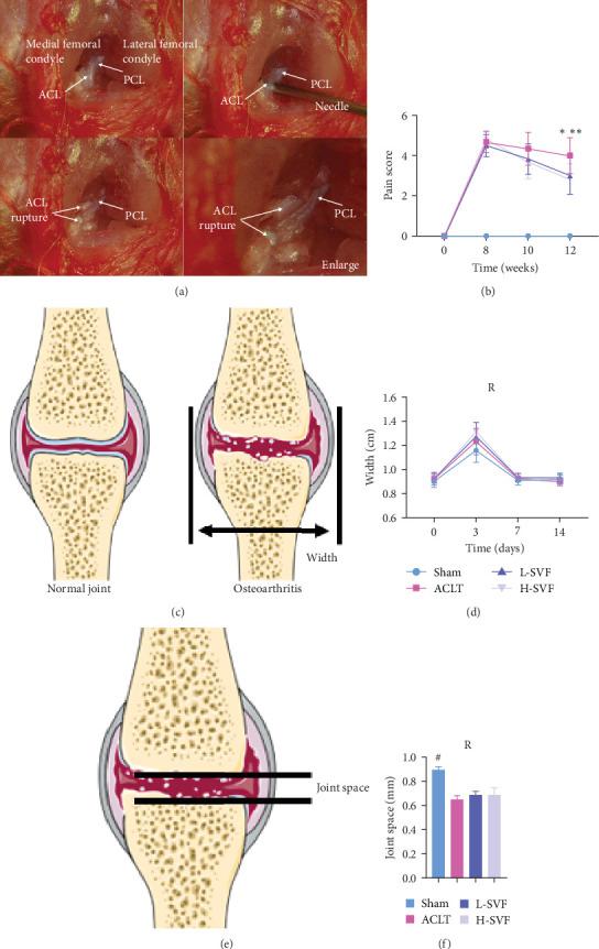 https://cdn.ncbi.nlm.nih.gov/pmc/blobs/661a/11987068/bf7b289e013d/SCI2025-5356264.001.jpg