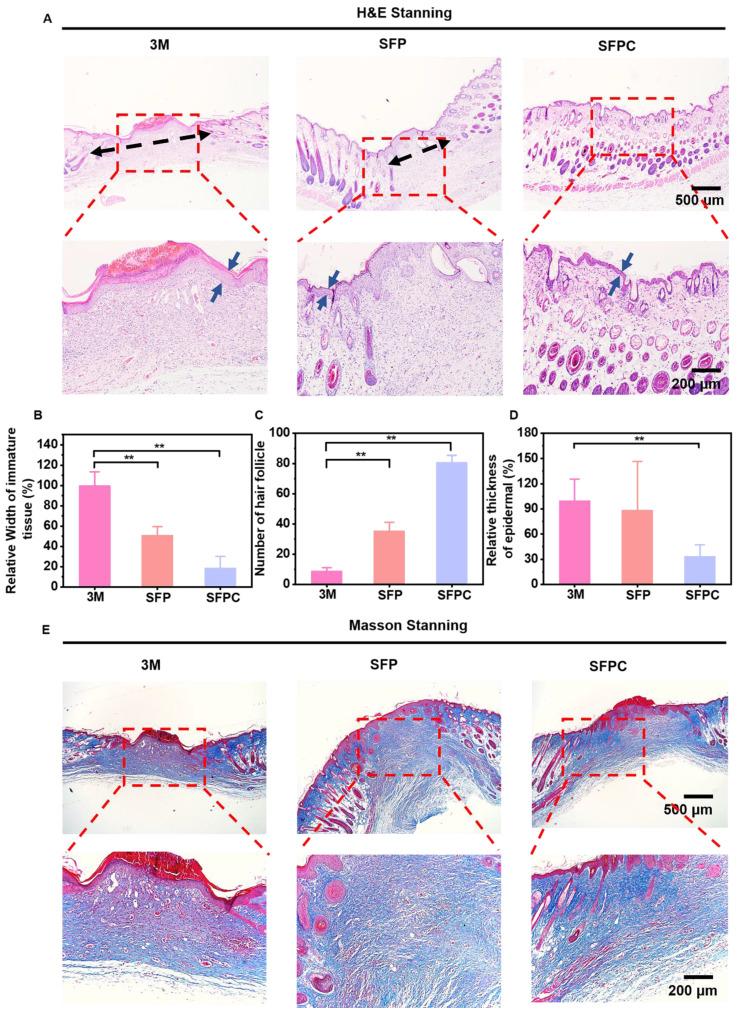 https://cdn.ncbi.nlm.nih.gov/pmc/blobs/661a/12203806/8d755ee3cc9f/thnov15p6882g008.jpg