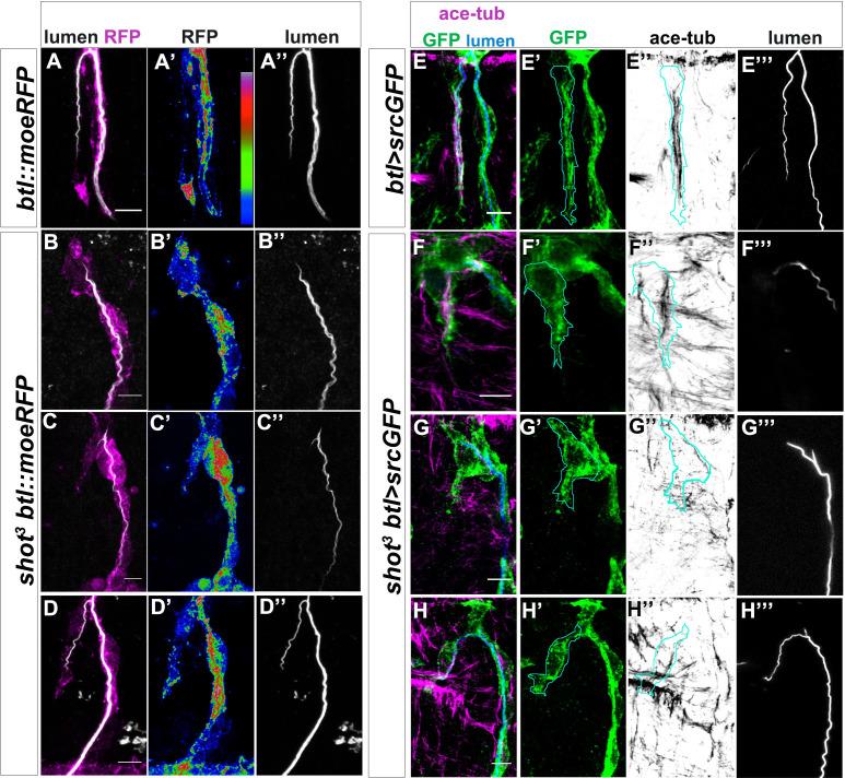 https://cdn.ncbi.nlm.nih.gov/pmc/blobs/661b/7661041/4189e997ab69/elife-61111-fig5.jpg