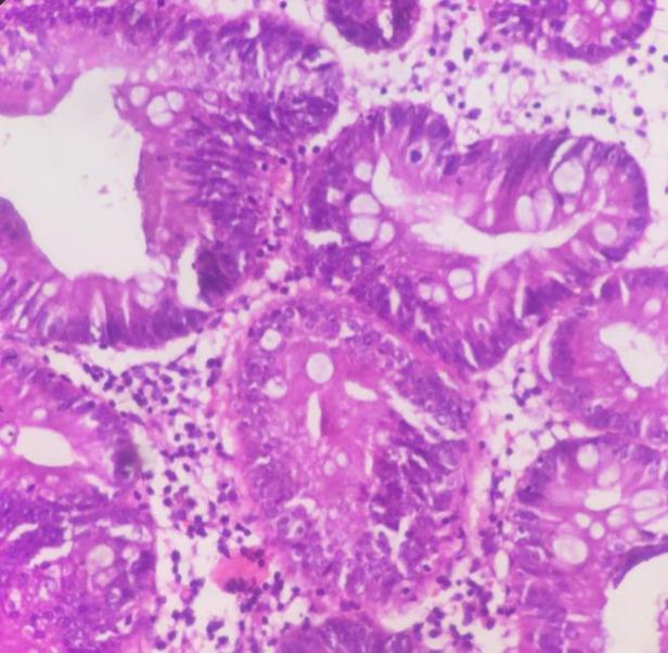 https://cdn.ncbi.nlm.nih.gov/pmc/blobs/6622/7354064/4a795d0f4534/ijp-15-167-g003.jpg