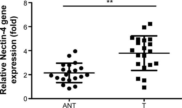 https://cdn.ncbi.nlm.nih.gov/pmc/blobs/6632/4708195/25318a5ee960/ott-9-183Fig1.jpg