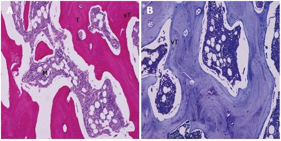 https://cdn.ncbi.nlm.nih.gov/pmc/blobs/663a/6153136/fd959d152a9e/WJO-9-120-g002.jpg