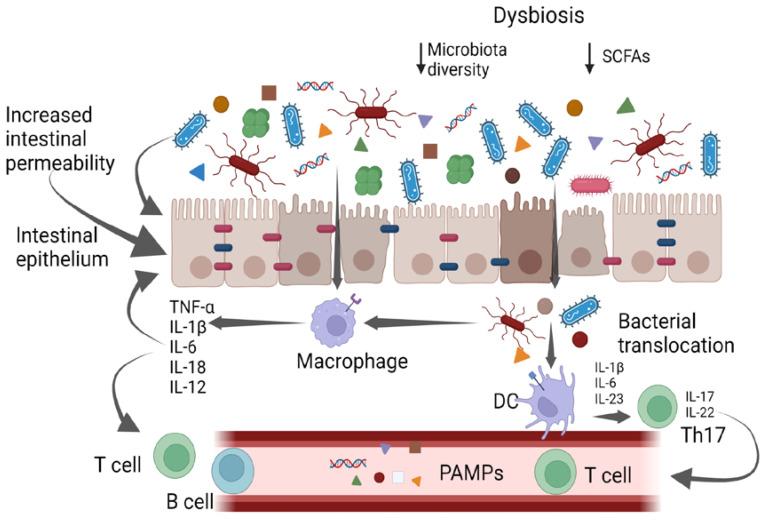 https://cdn.ncbi.nlm.nih.gov/pmc/blobs/6645/10215521/50e3a68bc2be/antibiotics-12-00868-g001.jpg