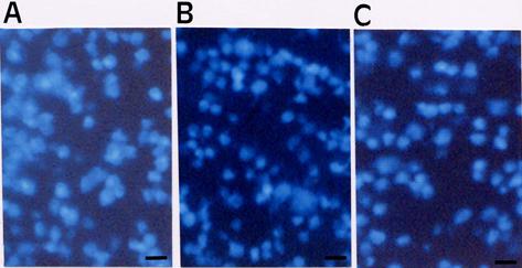 https://cdn.ncbi.nlm.nih.gov/pmc/blobs/664a/3283204/e4c90cbb753d/mv-v18-390-f2.jpg