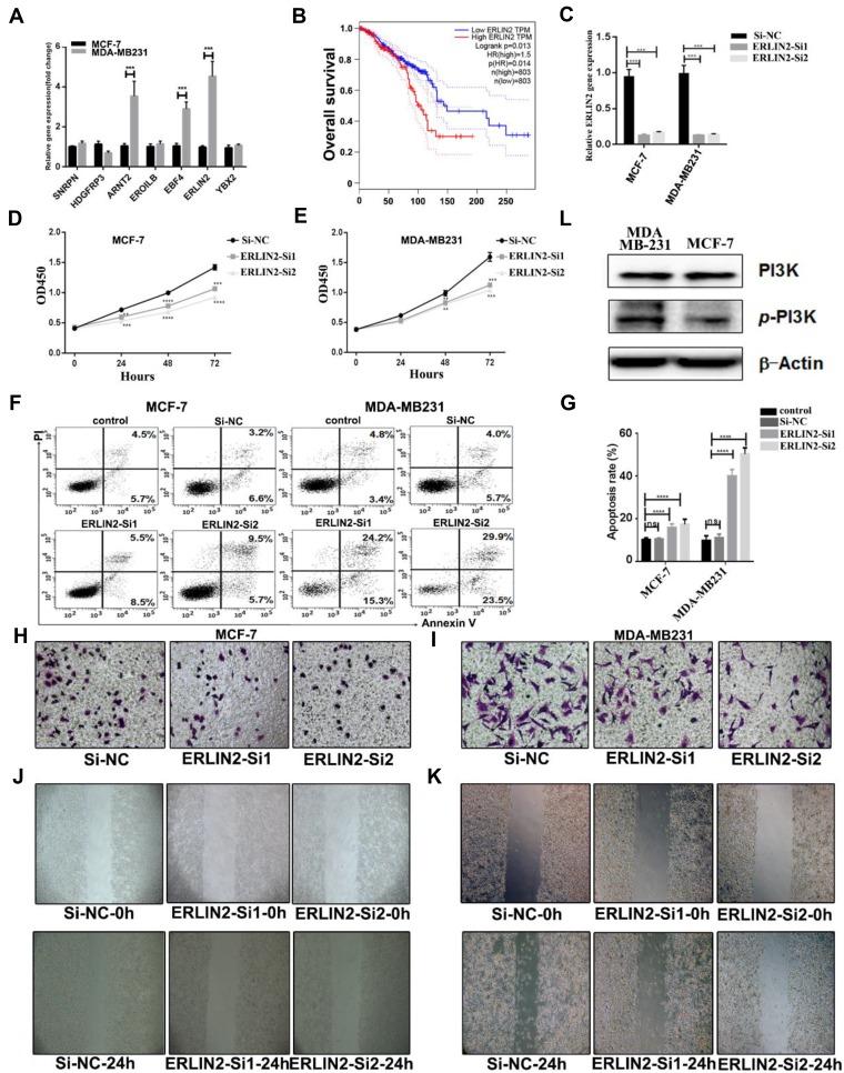 https://cdn.ncbi.nlm.nih.gov/pmc/blobs/6653/6968804/56eb99656c78/OTT-13-323-g0006.jpg