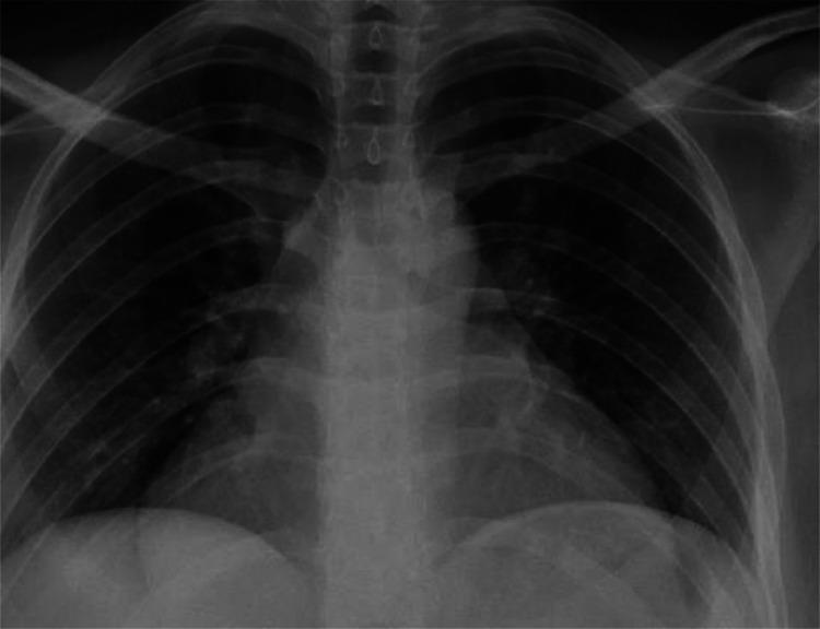 https://cdn.ncbi.nlm.nih.gov/pmc/blobs/6659/12049694/bb66834d4638/gr2.jpg