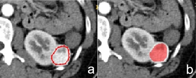 https://cdn.ncbi.nlm.nih.gov/pmc/blobs/665a/7907210/3fbeb7a4d748/41598_2021_84244_Fig5_HTML.jpg