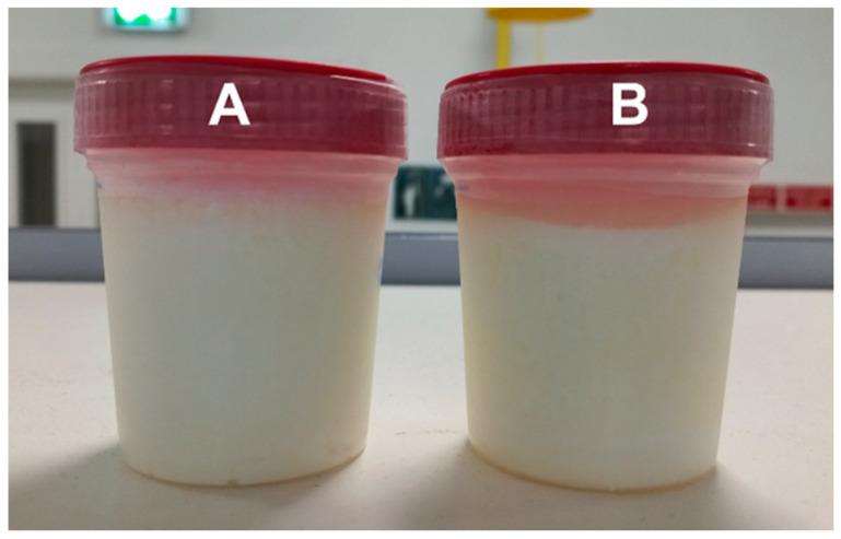 https://cdn.ncbi.nlm.nih.gov/pmc/blobs/665c/10777994/e263c8804f3b/foods-13-00021-g001.jpg