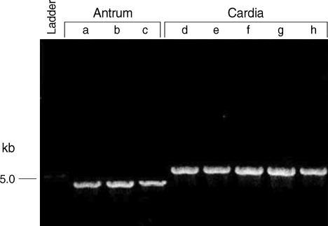 https://cdn.ncbi.nlm.nih.gov/pmc/blobs/665c/2800007/33f6298e49c5/jkms-25-61-g004.jpg