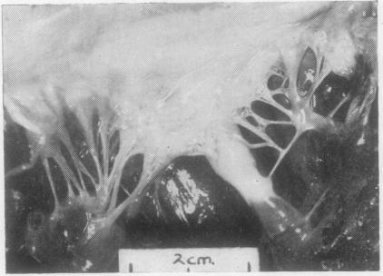 https://cdn.ncbi.nlm.nih.gov/pmc/blobs/665f/1018681/5fbbfb2a2cb4/thorax00066-0046-b.jpg