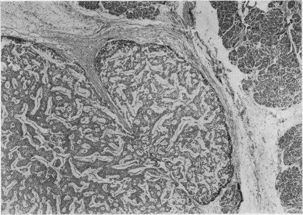 https://cdn.ncbi.nlm.nih.gov/pmc/blobs/665f/1018681/7c01ef38acd8/thorax00066-0045-a.jpg
