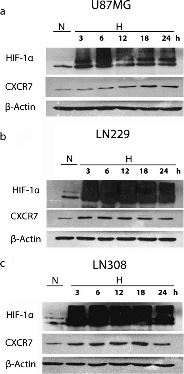 https://cdn.ncbi.nlm.nih.gov/pmc/blobs/6661/3728118/09303ea72927/1471-2407-13-347-1.jpg
