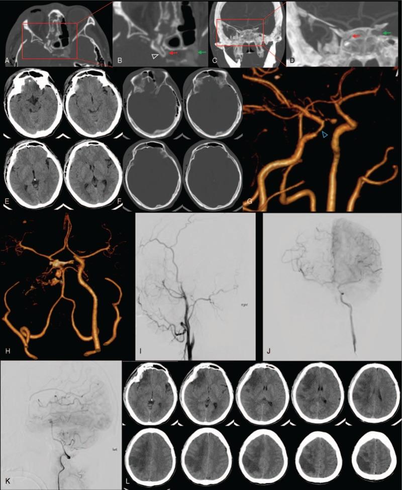 https://cdn.ncbi.nlm.nih.gov/pmc/blobs/6662/5690749/8ac11e974763/medi-96-e8523-g001.jpg