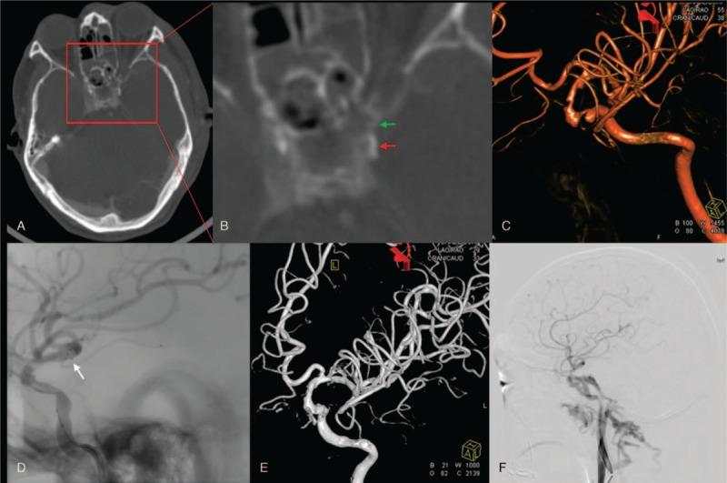 https://cdn.ncbi.nlm.nih.gov/pmc/blobs/6662/5690749/8bd357560e4b/medi-96-e8523-g002.jpg