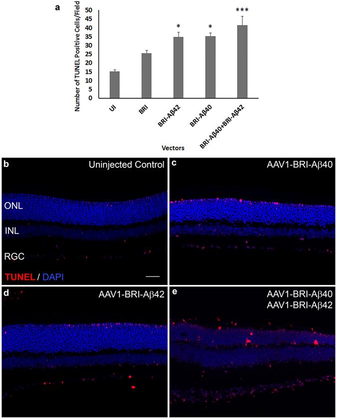 https://cdn.ncbi.nlm.nih.gov/pmc/blobs/6663/5468329/c5bffaf663ba/41598_2017_3397_Fig5_HTML.jpg