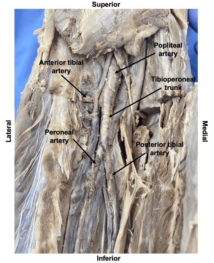 https://cdn.ncbi.nlm.nih.gov/pmc/blobs/6670/10496860/e19b637845fc/cureus-0015-00000043414-i02.jpg
