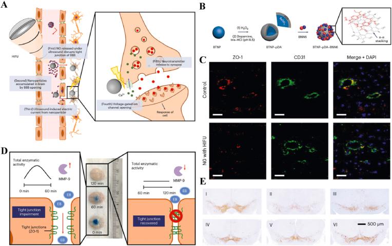 https://cdn.ncbi.nlm.nih.gov/pmc/blobs/6672/12281159/5adc3e9099a7/gr12.jpg