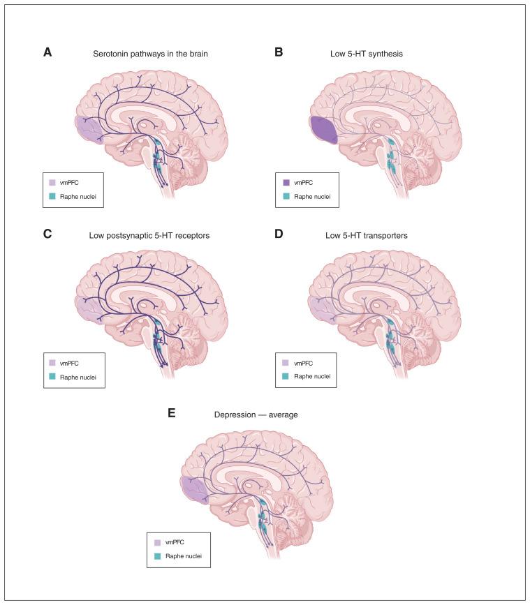 https://cdn.ncbi.nlm.nih.gov/pmc/blobs/6673/10599657/bbadec2706aa/48-5-e400f1.jpg