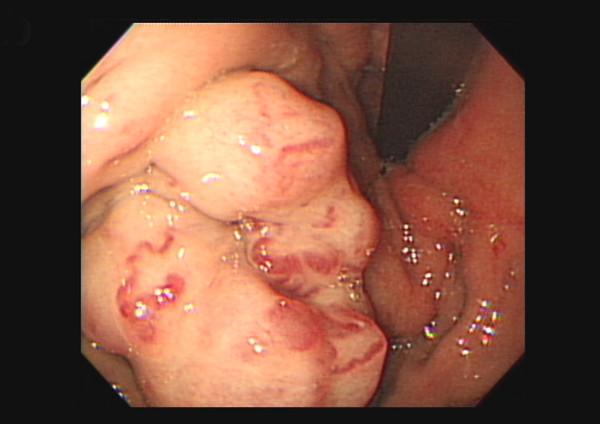 https://cdn.ncbi.nlm.nih.gov/pmc/blobs/6676/3438029/24664229ab0b/1477-7819-10-150-2.jpg