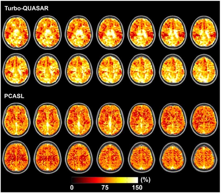 https://cdn.ncbi.nlm.nih.gov/pmc/blobs/667f/6899879/f7d91a854919/MRM-83-731-g005.jpg