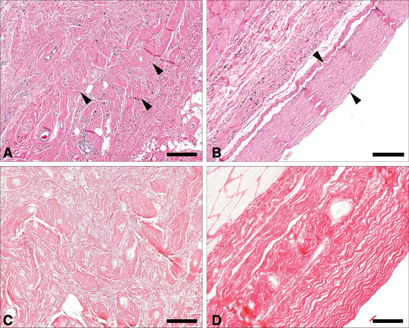 https://cdn.ncbi.nlm.nih.gov/pmc/blobs/6689/8751766/15fef8c5d301/gox-9-e3687-g012.jpg