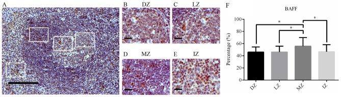 https://cdn.ncbi.nlm.nih.gov/pmc/blobs/668e/6364250/54a82cce61f0/etm-17-03-2053-g01.jpg