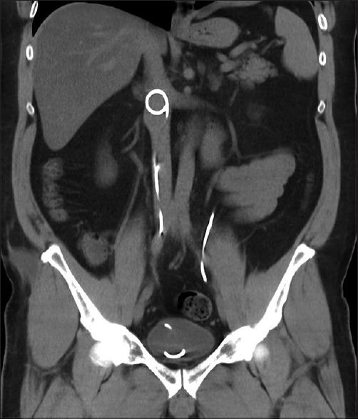 https://cdn.ncbi.nlm.nih.gov/pmc/blobs/6695/6362790/993a47d8fbee/UA-11-93-g002.jpg