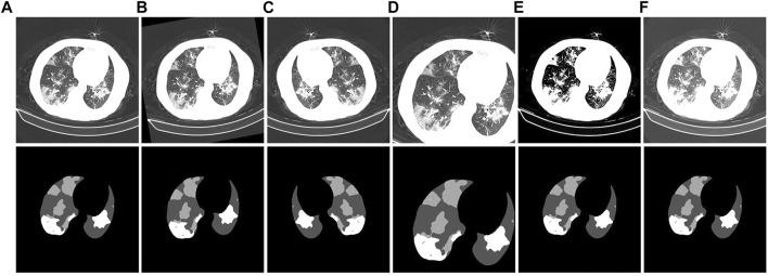 https://cdn.ncbi.nlm.nih.gov/pmc/blobs/66a1/9441795/25998b4d7e5b/fphys-13-981463-g010.jpg