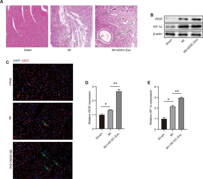 https://cdn.ncbi.nlm.nih.gov/pmc/blobs/66a1/9972746/984f574c5386/13062_2023_361_Fig4_HTML.jpg