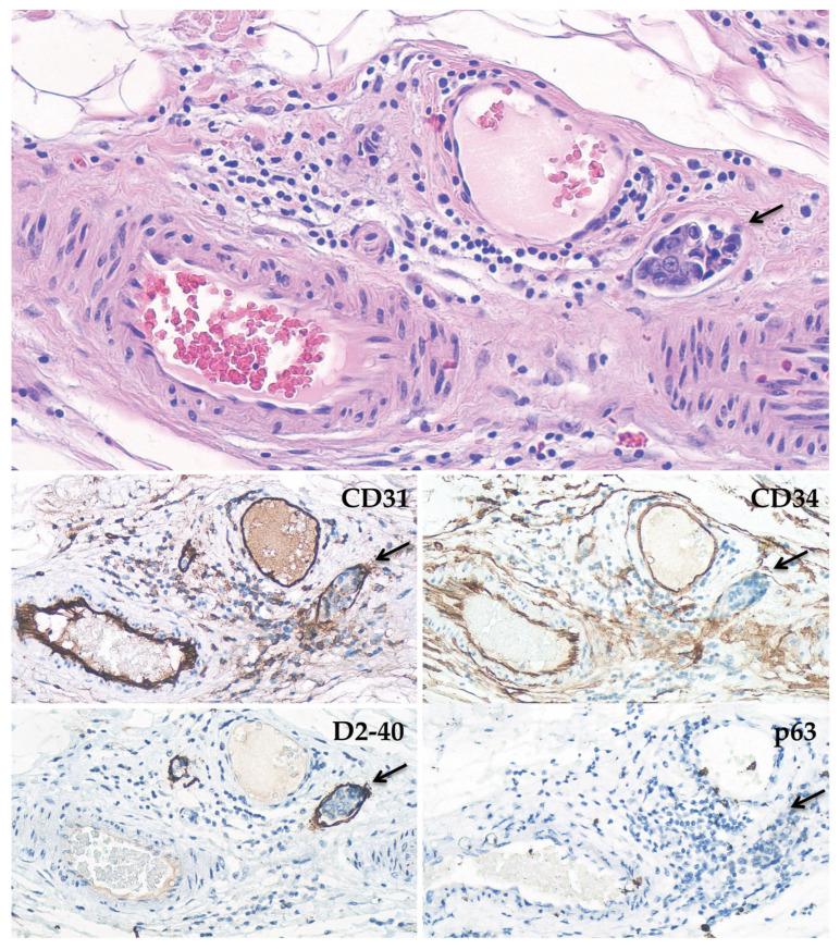 https://cdn.ncbi.nlm.nih.gov/pmc/blobs/66a3/10046167/2d8aa762e4b5/biomedicines-11-00968-g001.jpg