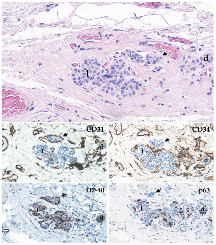 https://cdn.ncbi.nlm.nih.gov/pmc/blobs/66a3/10046167/fcaa50d84037/biomedicines-11-00968-g002.jpg