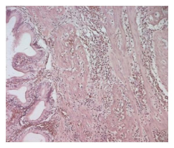 https://cdn.ncbi.nlm.nih.gov/pmc/blobs/66a6/3806378/f53100bac061/CRIM.UROLOGY2013-146020.004.jpg