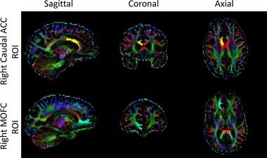 https://cdn.ncbi.nlm.nih.gov/pmc/blobs/66a8/5057306/780eb353298c/DA-33-56-g001.jpg
