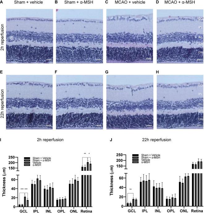 https://cdn.ncbi.nlm.nih.gov/pmc/blobs/66ab/8914517/fc48d2f80a3d/fnins-16-799739-g002.jpg