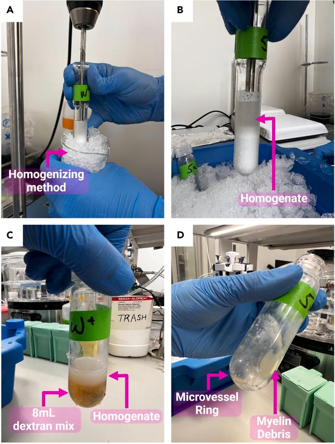 https://cdn.ncbi.nlm.nih.gov/pmc/blobs/66b0/11760319/06b1ce503cf8/gr1.jpg