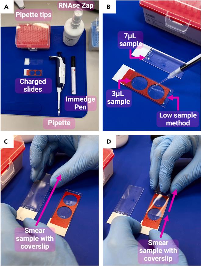 https://cdn.ncbi.nlm.nih.gov/pmc/blobs/66b0/11760319/591155619edc/gr2.jpg