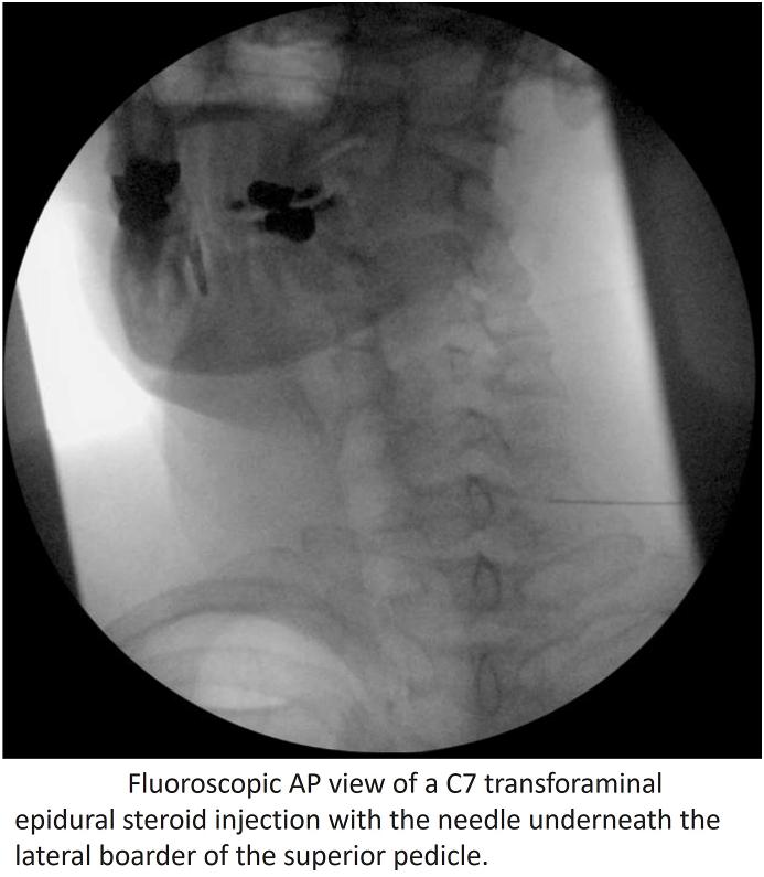 https://cdn.ncbi.nlm.nih.gov/pmc/blobs/66b4/11914747/0f08e1a027d5/gr3.jpg
