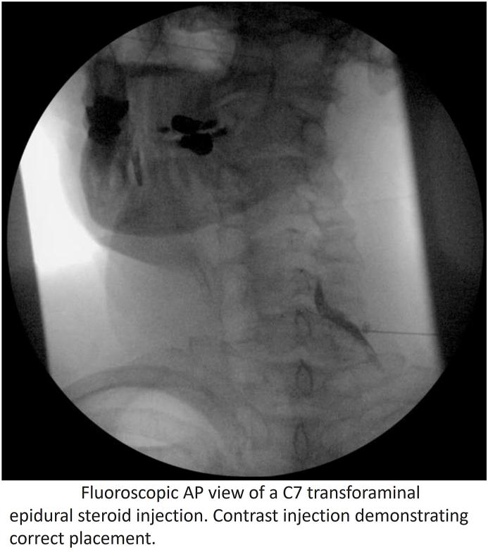 https://cdn.ncbi.nlm.nih.gov/pmc/blobs/66b4/11914747/4d0fce35d859/gr4.jpg