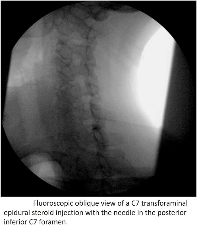 https://cdn.ncbi.nlm.nih.gov/pmc/blobs/66b4/11914747/c051763400d6/gr2.jpg