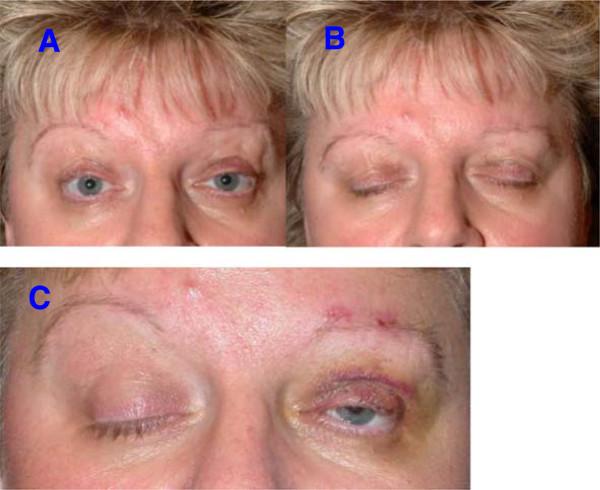 https://cdn.ncbi.nlm.nih.gov/pmc/blobs/66bd/4213496/93ad2a72c112/13005_2014_364_Fig3_HTML.jpg