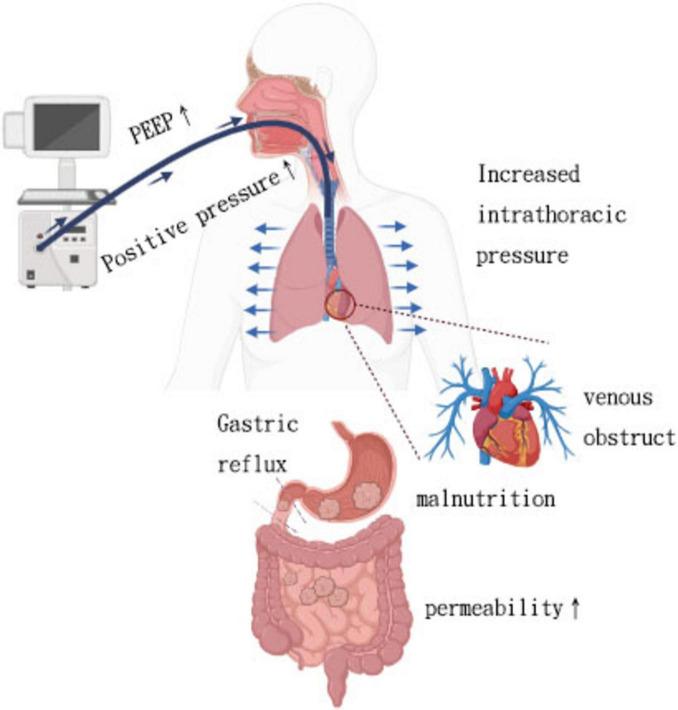 https://cdn.ncbi.nlm.nih.gov/pmc/blobs/66c5/12343513/1126e413ef8a/fmed-12-1624907-g001.jpg