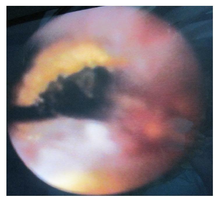 https://cdn.ncbi.nlm.nih.gov/pmc/blobs/66c6/5976910/95a3242468de/MIS2018-8080625.001.jpg