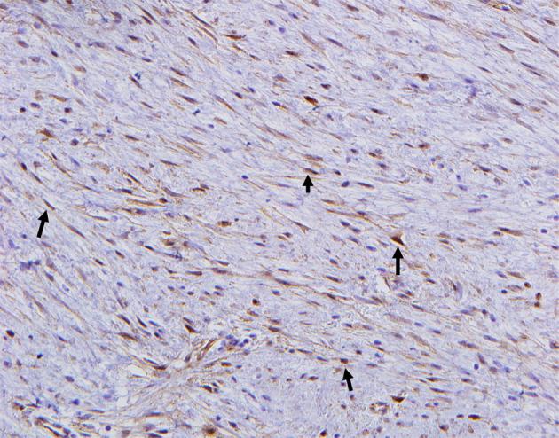 https://cdn.ncbi.nlm.nih.gov/pmc/blobs/66cc/11092408/0a7b92b4b8d7/wjon-15-394-g002.jpg